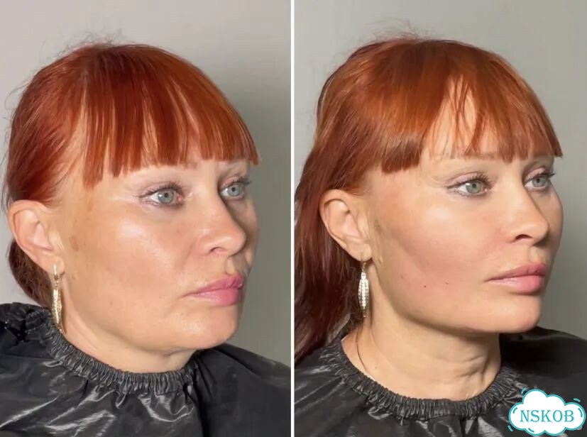 Фулл фейс фото 10