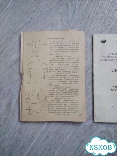 Аппарат Светлана рт-05 фото 3