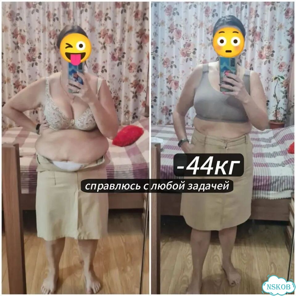 Результат с 1 сеанса от -3 до -24см / Lpg+RET+MC фото 10